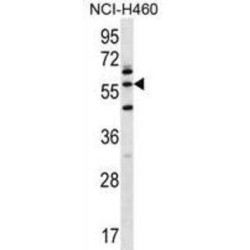 Leucine Zipper And EF-Hand Containing Transmembrane Protein 2 (LETM2) Antibody