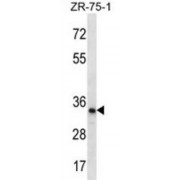 WB analysis of ZR-75-1 cell lysates.