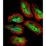 Translin (TSN) Antibody