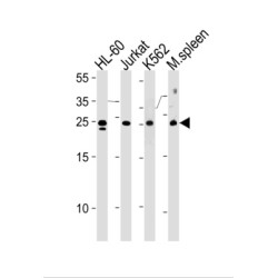 Translin (TSN) Antibody