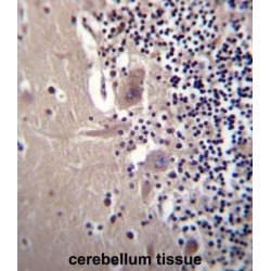 Crystallin Beta A1 (CRYBA1) Antibody