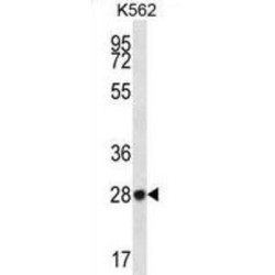 Zinc Finger Protein 146 (ZNF146) Antibody