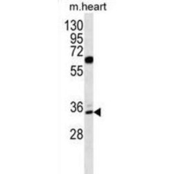 Zinc Finger Protein 146 (ZNF146) Antibody