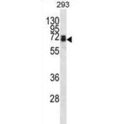 WB analysis of HEK293 cell lysates, using DLL3 antibody.