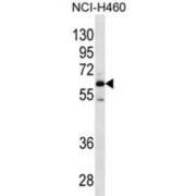 Matrix Extracellular Phosphoglycoprotein (MEPE) Antibody