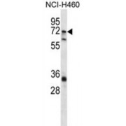 Alpha-N-Acetylgalactosaminide Alpha-2,6-Sialyltransferase 1 (ST6GALNAC1) Antibody