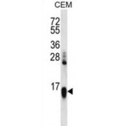 Histone Cluster 1, H2aa (HIST1H2AA) Antibody
