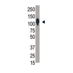 SUMO Specific Peptidase 6 (SENP6) Antibody