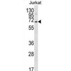 Prosaposin-Like 1 (PSAPL1) Antibody