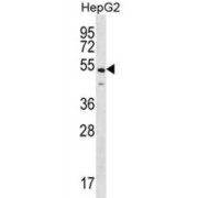 NF-Kappa-B-Activating Protein (NKAP) Antibody
