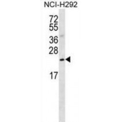 Protein Slowmo Homolog 2 (SLMO2) Antibody