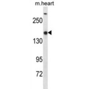SET1B Antibody