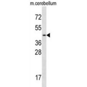 Transcription Factor 7-Like 2 (TCF7L2) Antibody