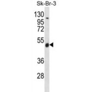 WD Repeat-Containing Protein 34 (WDR34) Antibody