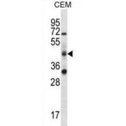 RNA Binding Motif Protein 42 (RBM42) Antibody