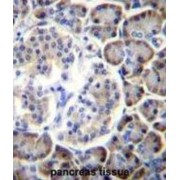 Stromal Membrane-Associated Protein 2 (SMAP2) Antibody