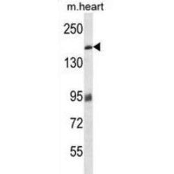 Myosin Binding Protein C, Cardiac (MYBPC3) Antibody