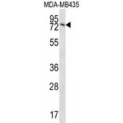 Protein Unc-84 Homolog B (UNC84B) Antibody