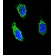 Ribonuclease/angiogenin Inhibitor 1 (RNH1) Antibody