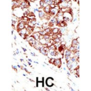 Protein Inhibitor of Activated STAT 1 (PIAS1) Antibody