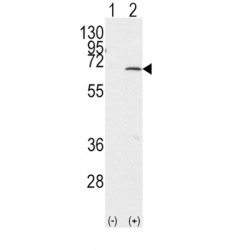 Protein Inhibitor of Activated STAT 1 (PIAS1) Antibody