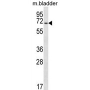 Eyes Absent Homolog 1 (EYA1) Antibody