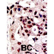 Protein Inhibitor of Activated STAT3 (PIAS3) Antibody