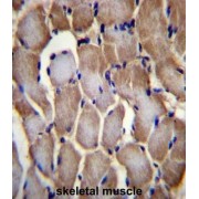 Selenoprotein N (SEPN1) Antibody