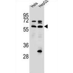 Selenoprotein N (SEPN1) Antibody