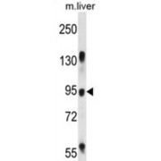 RasGAP-Activating-Like Protein 1 (RASAL1) Antibody