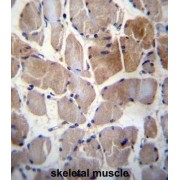 Ribosomal Protein S6 Kinase C1 (RPS6KC1) Antibody
