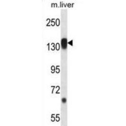 Ribosomal Protein S6 Kinase C1 (RPS6KC1) Antibody