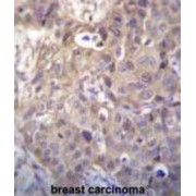 Homeodomain Interacting Protein Kinase 1 (HIPK1) Antibody