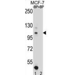Homeodomain Interacting Protein Kinase 1 (HIPK1) Antibody