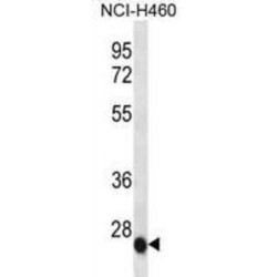 Interleukin 6 (IL6) Antibody