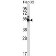 WD Repeat-Containing Protein 85 (WDR85) Antibody