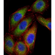 Mitogen-Activated Protein Kinase 14 (MAPK14) Antibody