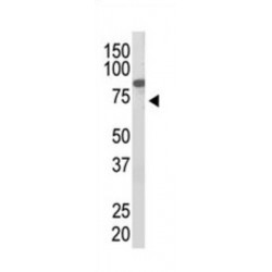 Protein Inhibitor of Activated STAT2 (PIAS2) Antibody