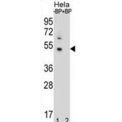 DnaJ (Hsp40) Homolog, Subfamily B, Member 6 (DNAJB6) Antibody