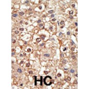 E3 SUMO-Protein Ligase PIAS4 (PIAS4) Antibody