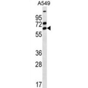 Zinc Finger Protein 835 (ZNF835) Antibody