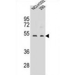 WD Repeat-Containing Protein 86 (WDR86) Antibody
