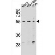 Zinc Finger Protein 117 (ZNF117) Antibody