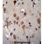 Leucine-Rich Repeat-Containing Protein 28 (LRRC28) Antibody