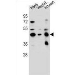 Leucine-Rich Repeat-Containing Protein 28 (LRRC28) Antibody