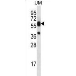 Lipase Member M (LIPM) Antibody