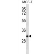 Testis Serine Protease 1 (TESSP1) Antibody