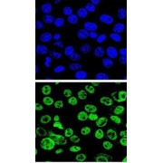 Mdm2 p53 Binding Protein Homolog (MDM2) Antibody