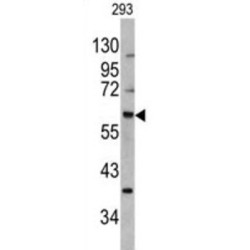 Mdm2 p53 Binding Protein Homolog (MDM2) Antibody