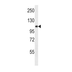 Lysosomal Alpha Glucosidase (GAA) Antibody
